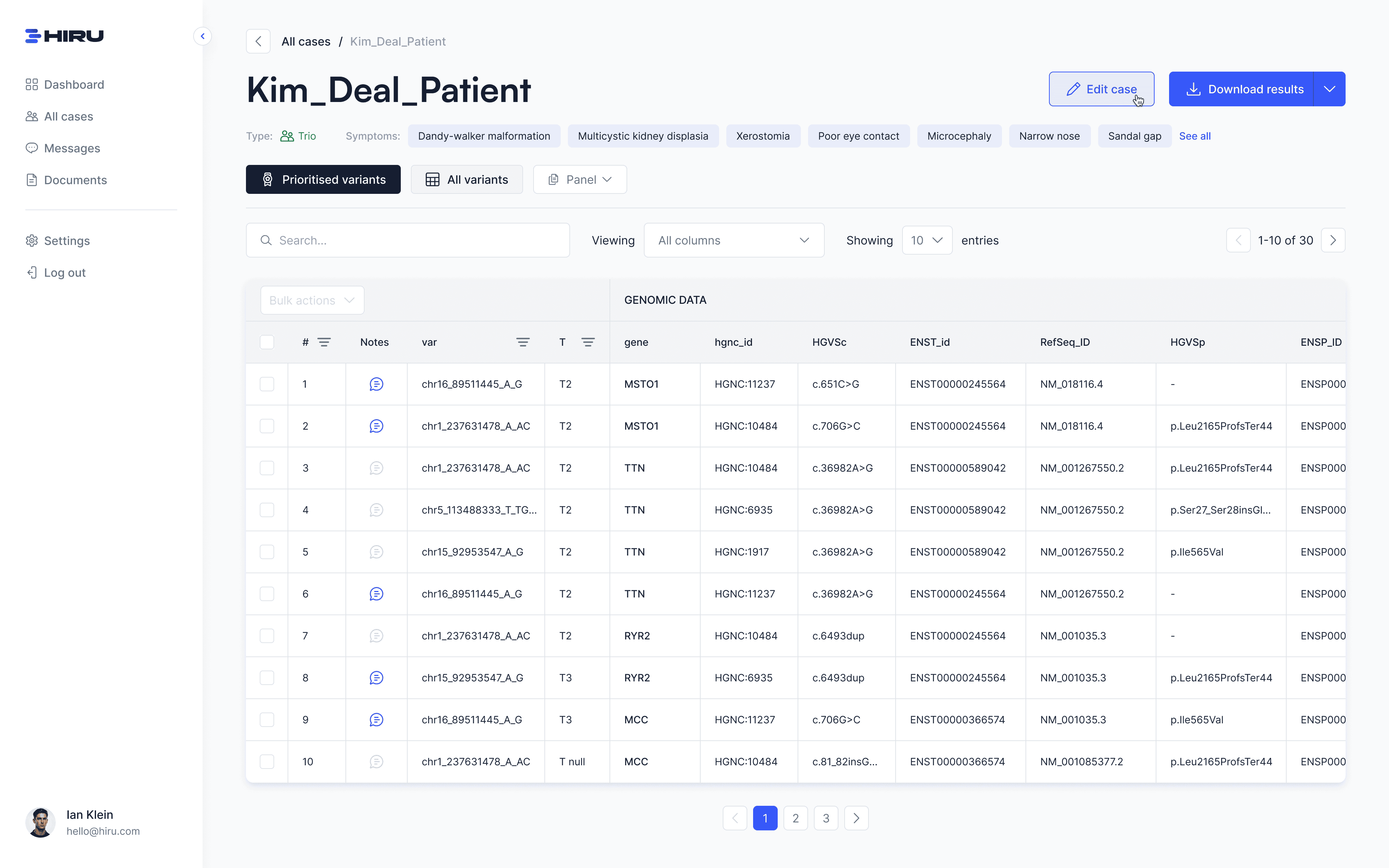 HIRU - Fujitsu - Project Screenshot